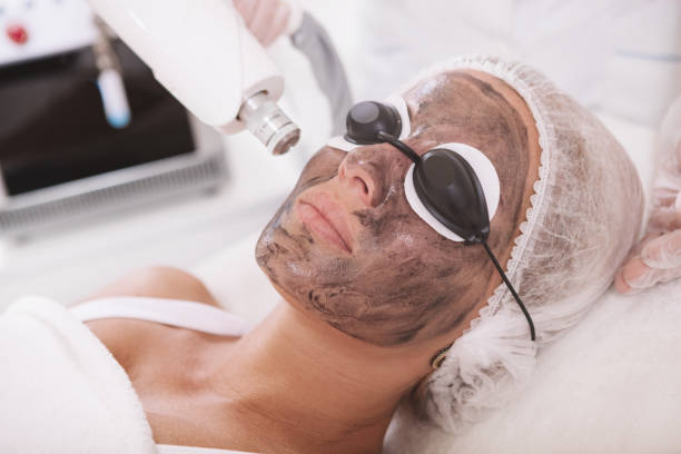 facial laser treatment near me - laser facial