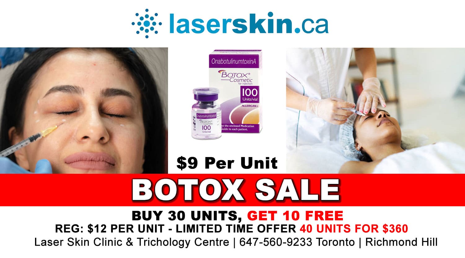 how-long-does-botox-last-promo