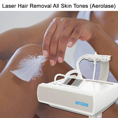 aerolase-laser-hair-removal