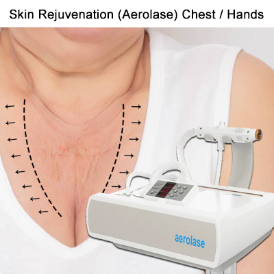 aerolase-laser-skin-rejuvenation-chest-hands