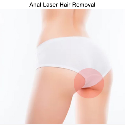 Anal laser hair removal Toronto