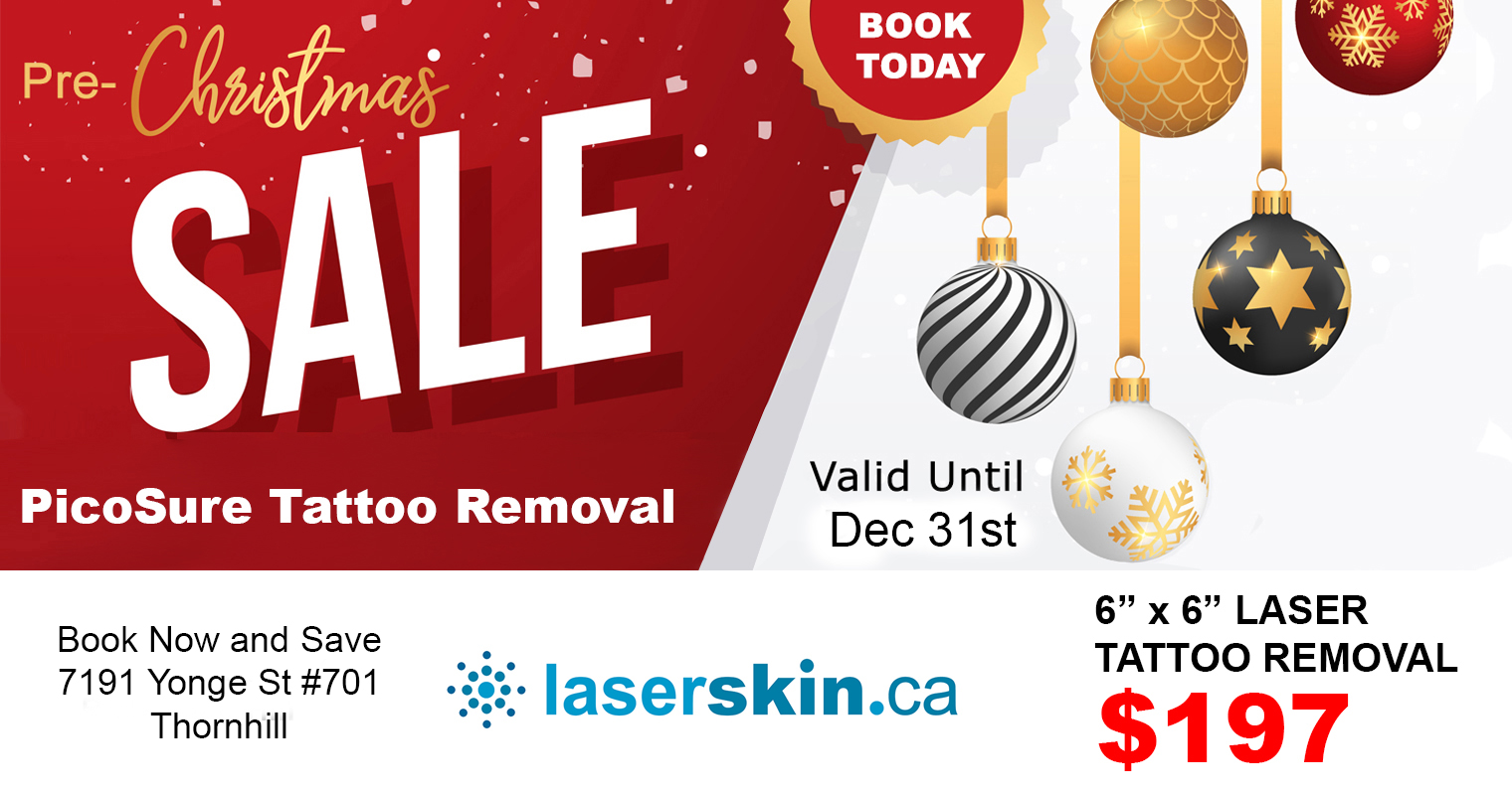 Laser-tattoo-removal-cost