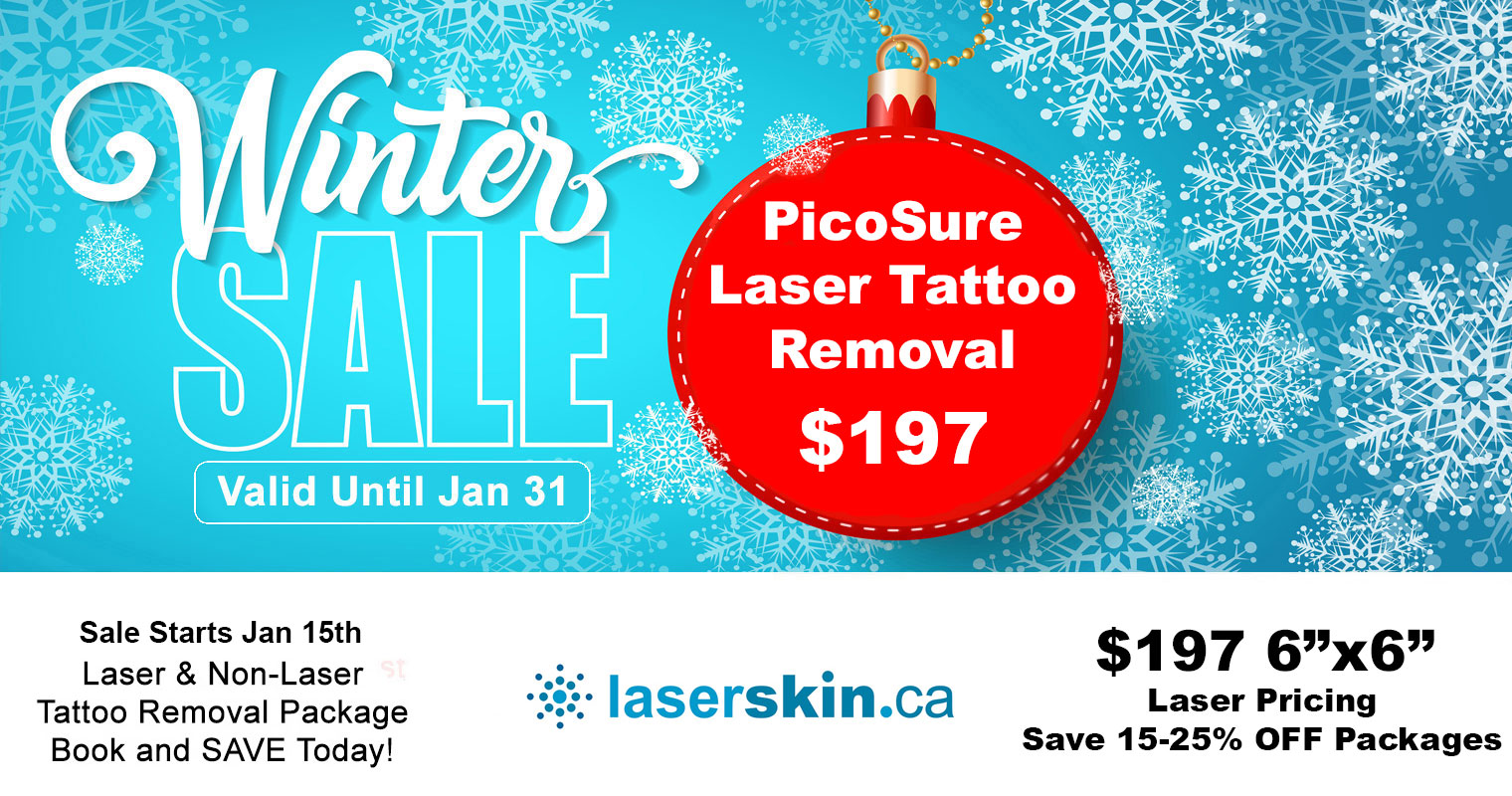 laser tattoo removal cost