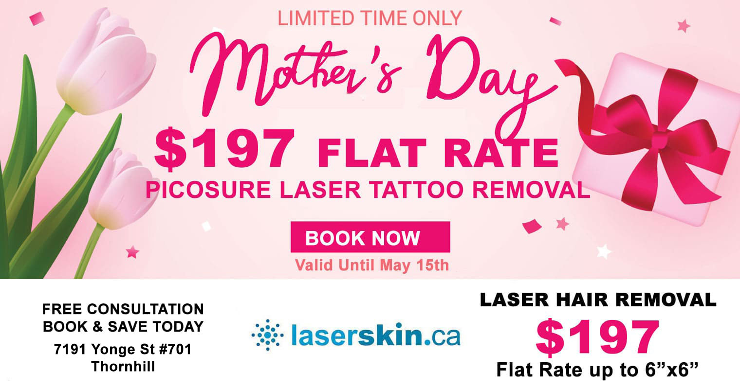 laser-tattoo-removal-cost