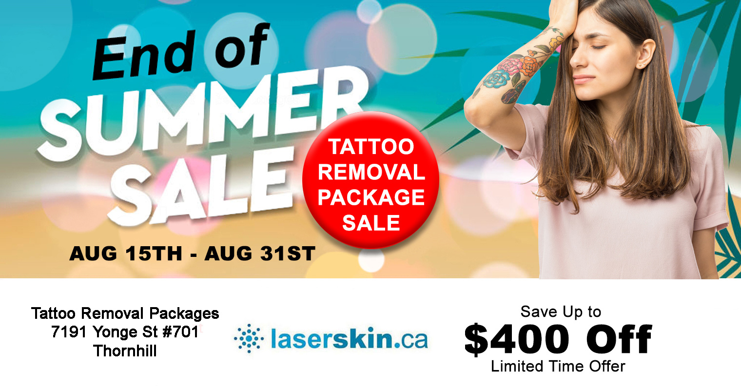 picosure laser tattoo removal cost